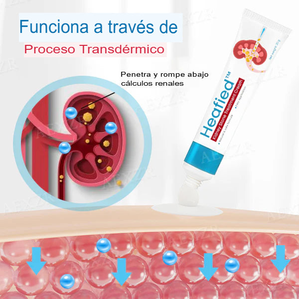 Crema para cálculos renales Heafied™