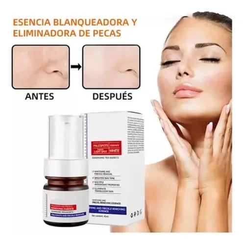 Crema facial blanqueadora para pecas, elimina el melasma y las manchas oscuras