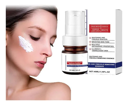 Crema facial blanqueadora para pecas, elimina el melasma y las manchas oscuras