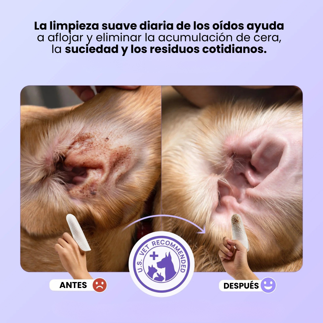 TOALLITAS DE DEDO EAR RELIEF + Sistema de Limpieza Botánica (Pack x50)
