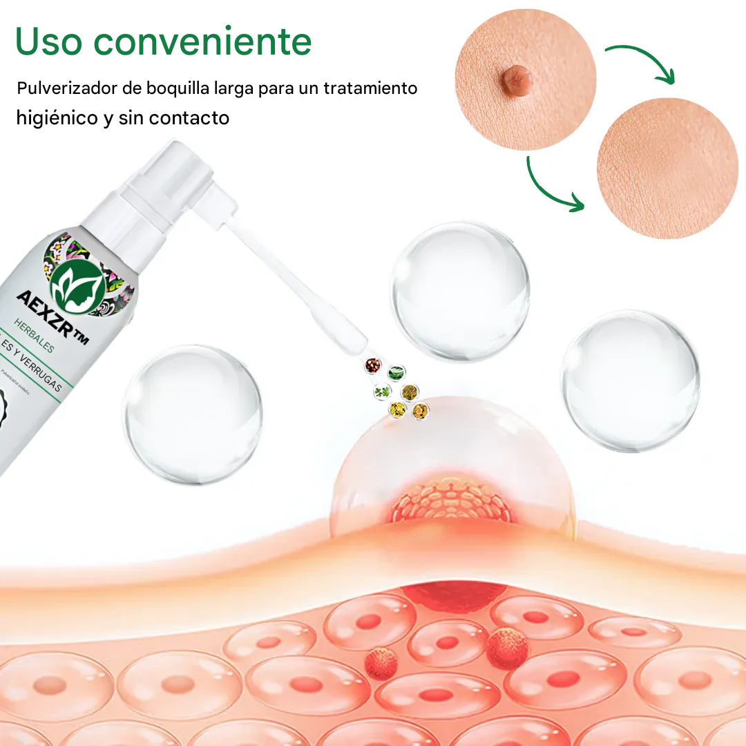 AEXZR™ Spray a base de hierbas para eliminar lunares y verrugas