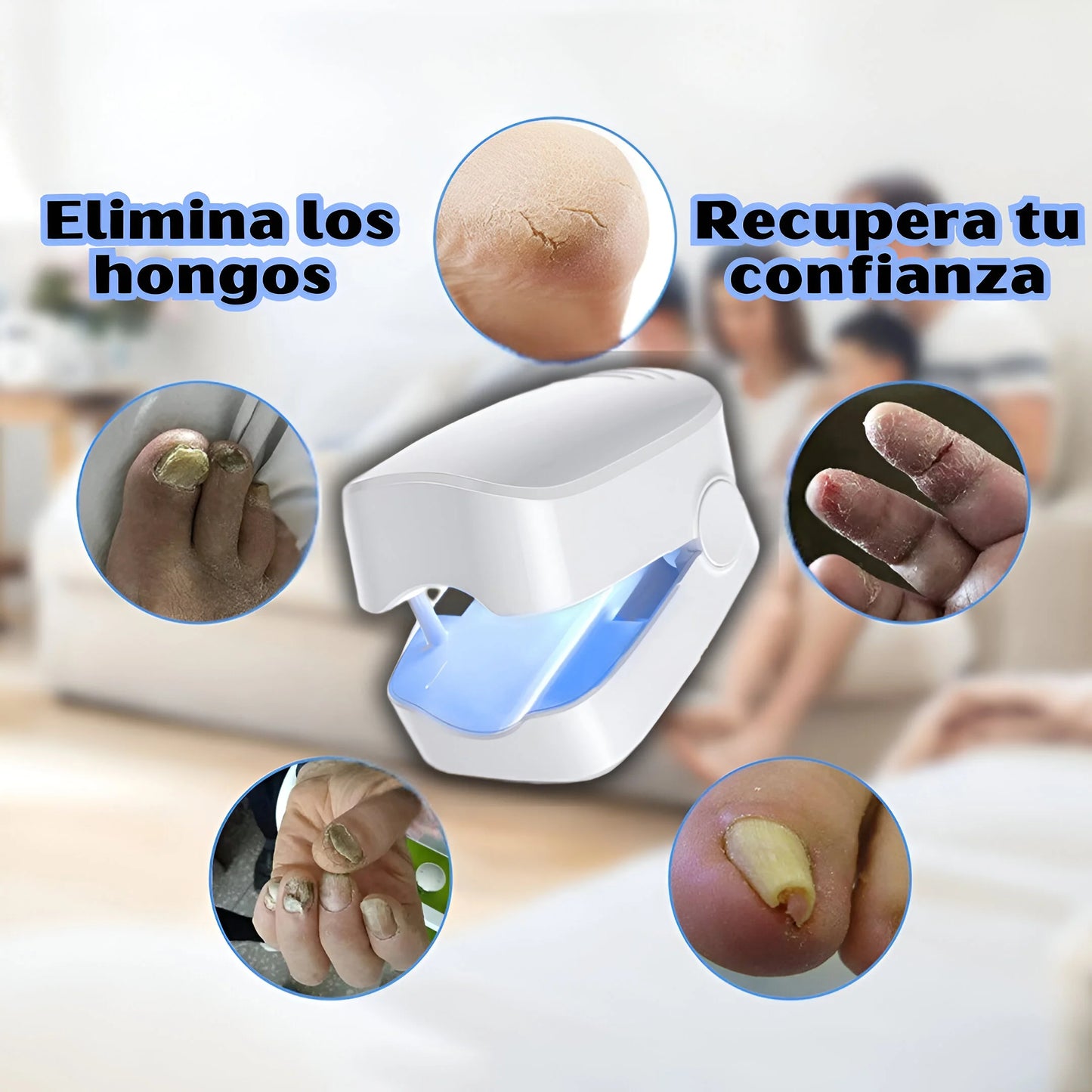 TRATAMIENTO LÁSER EFECTIVO PARA HONGOS EN LAS UÑAS